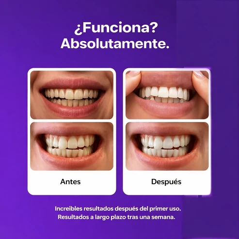 Whitening Strips